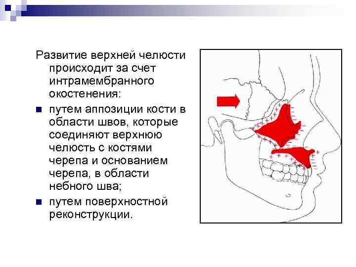 Развитие верхней челюсти происходит за счет интрамембранного окостенения: n путем аппозиции кости в области