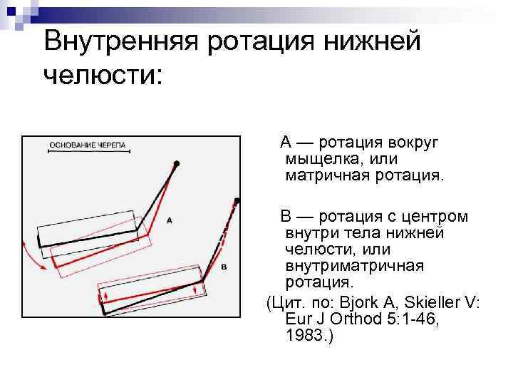 Внутренняя ротация нижней челюсти: А — ротация вокруг мыщелка, или матричная ротация. В —