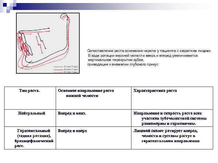 Сопоставление роста основания черепа у пациента с «коротким лицом» . В ходе ротации верхней