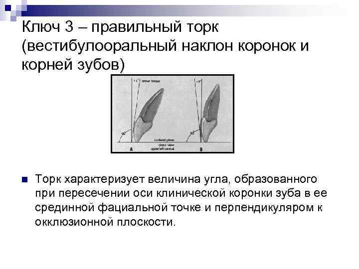 Ключ 3 – правильный торк (вестибулооральный наклон коронок и корней зубов) n Торк характеризует