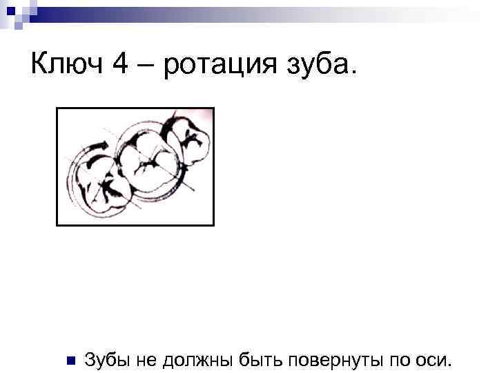 Ключ 4 – ротация зуба. n Зубы не должны быть повернуты по оси. 