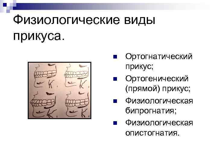 Физиологические виды прикуса. n n Ортогнатический прикус; Ортогенический (прямой) прикус; Физиологическая бипрогнатия; Физиологическая опистогнатия.