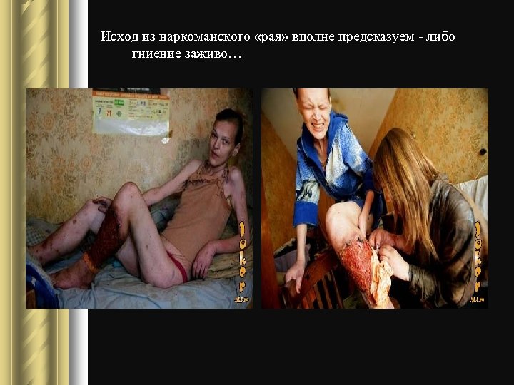 Исход из наркоманского «рая» вполне предсказуем - либо гниение заживо… 