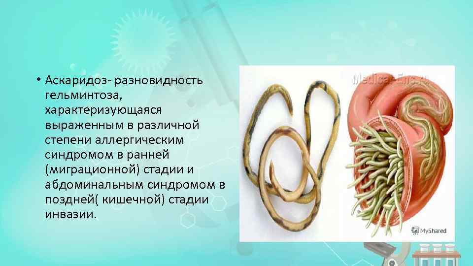  • Аскаридоз- разновидность гельминтоза, характеризующаяся выраженным в различной степени аллергическим синдромом в ранней