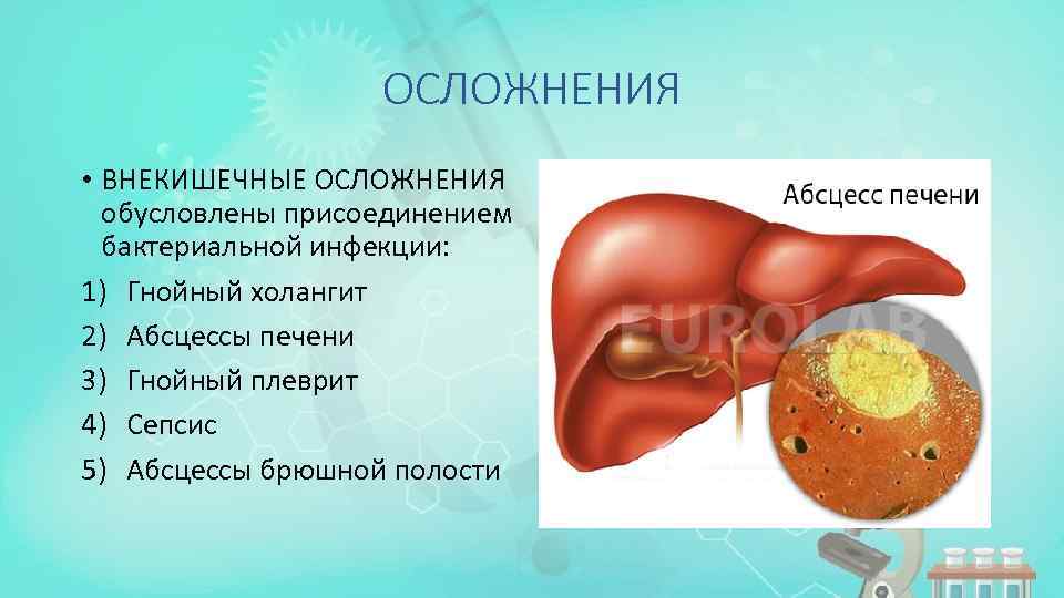 ОСЛОЖНЕНИЯ • ВНЕКИШЕЧНЫЕ ОСЛОЖНЕНИЯ обусловлены присоединением бактериальной инфекции: 1) Гнойный холангит 2) Абсцессы печени