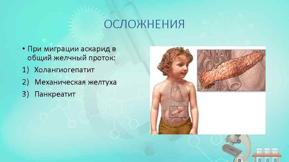 ОСЛОЖНЕНИЯ • При миграции аскарид в общий желчный проток: 1) Холангиогепатит 2) Механическая желтуха