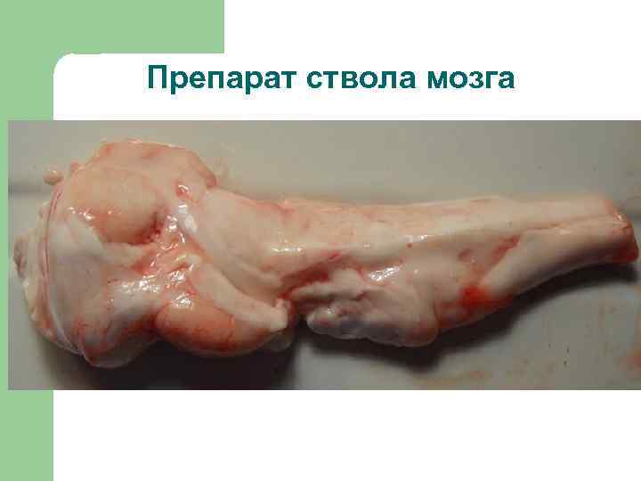 Препарат ствола мозга 