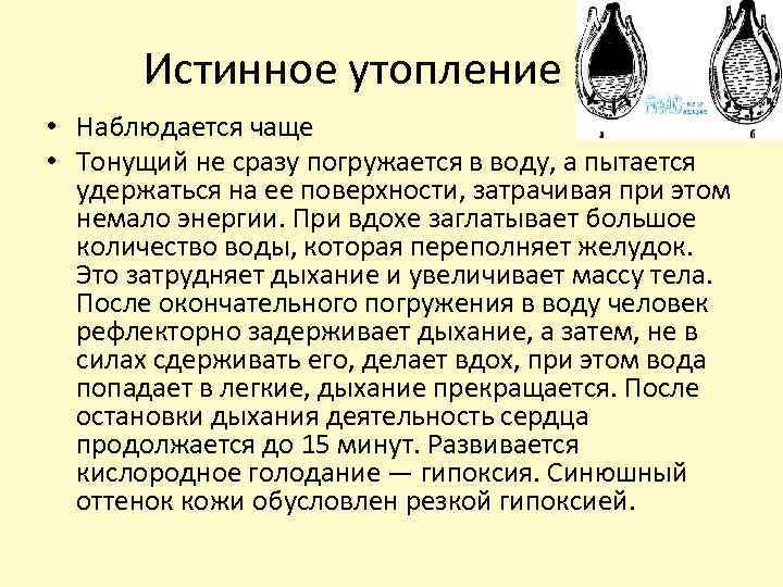 Истинное утопление • Наблюдается чаще • Тонущий не сразу погружается в воду, а пытается