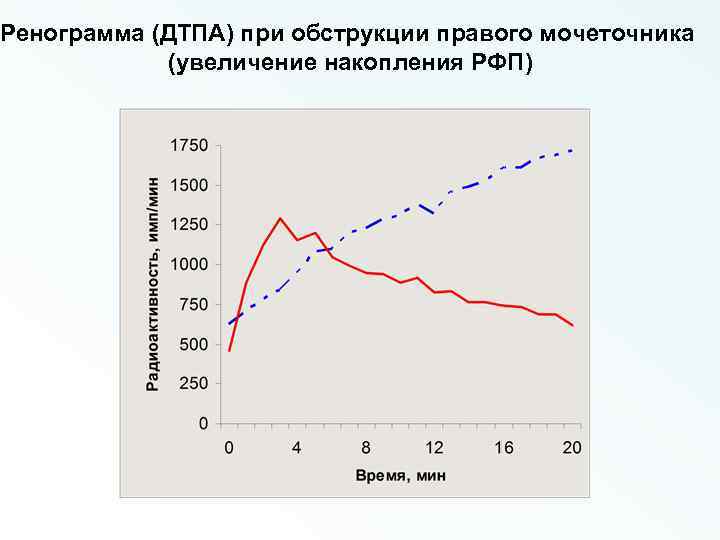 Ренограмма (ДТПА) при обструкции правого мочеточника (увеличение накопления РФП) 