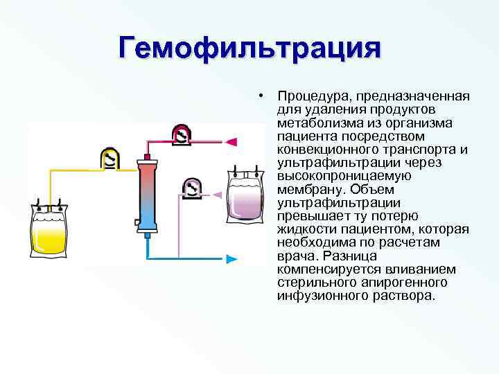 Гемофильтрация • Процедура, предназначенная для удаления продуктов метаболизма из организма пациента посредством конвекционного транспорта