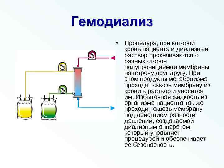 Гемодиализ • Процедура, при которой кровь пациента и диализный раствор прокачиваются с разных сторон