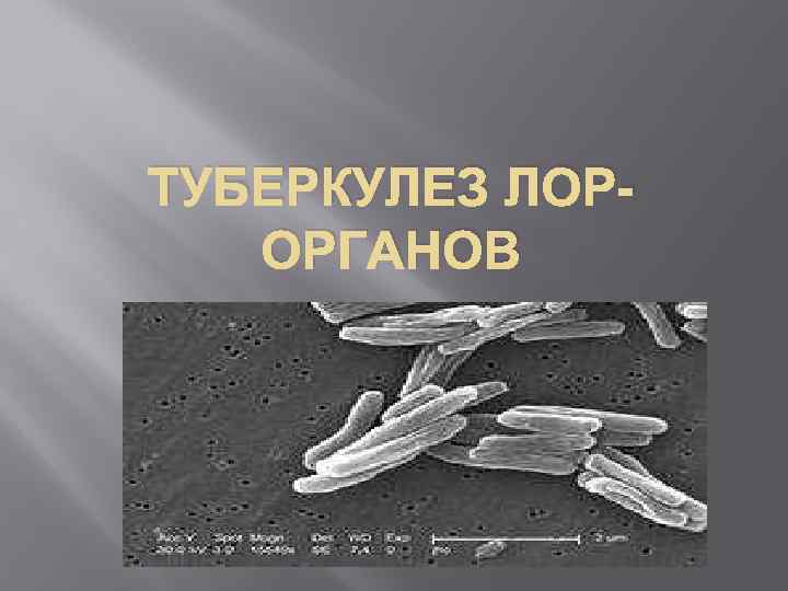 ТУБЕРКУЛЕЗ ЛОР- ОРГАНОВ 