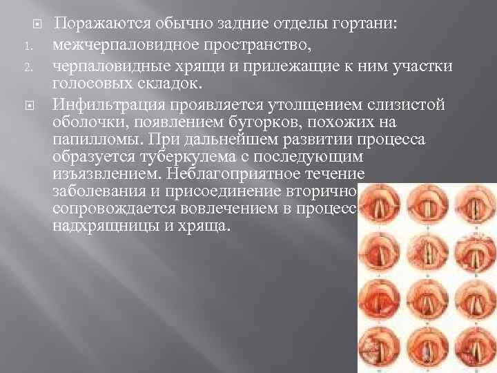  1. 2. Поражаются обычно задние отделы гортани: межчерпаловидное пространство, черпаловидные хрящи и прилежащие