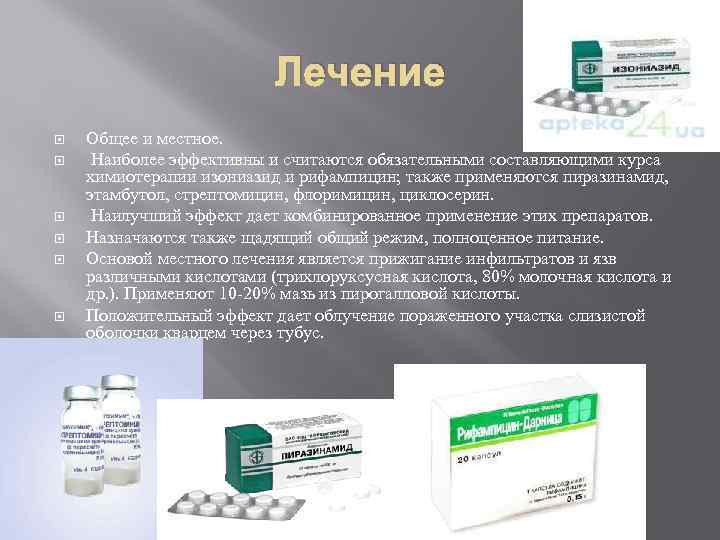 Лечение Общее и местное. Наиболее эффективны и считаются обязательными составляющими курса химиотерапии изониазид и