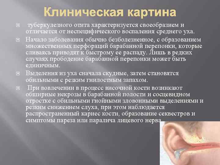 Клиническая картина туберкулезного отита характеризуется своеобразием и отличается от неспецифического воспаления среднего уха. Начало
