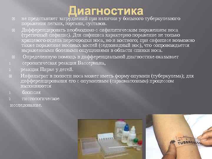  Диагностика не представляет затруднений при наличии у больного туберкулезного поражения легких, гортани, суставов.
