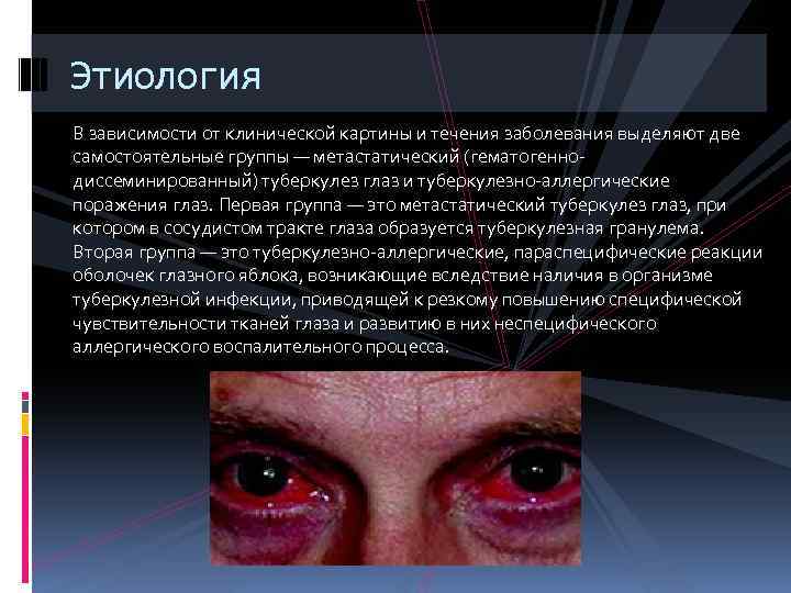 Этиология В зависимости от клинической картины и течения заболевания выделяют две самостоятельные группы —