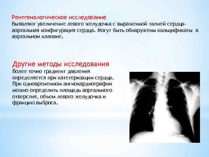 Рентгенологическое исследование Выявляют увеличение левого желудочка с выраженной талией сердцааортальная конфигурация сердца. Могут быть