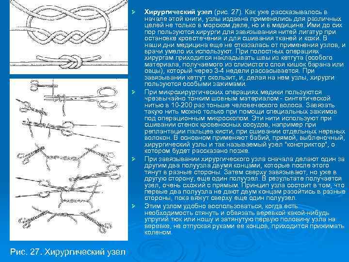 Ø Ø Рис. 27. Хирургический узел (рис. 27). Как уже рассказывалось в начале этой