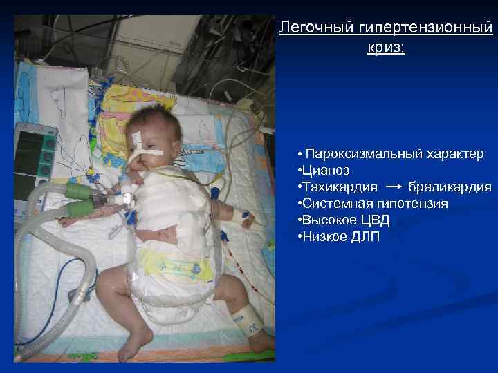 Легочный гипертензионный криз: • Пароксизмальный характер • Цианоз • Тахикардия брадикардия • Системная гипотензия