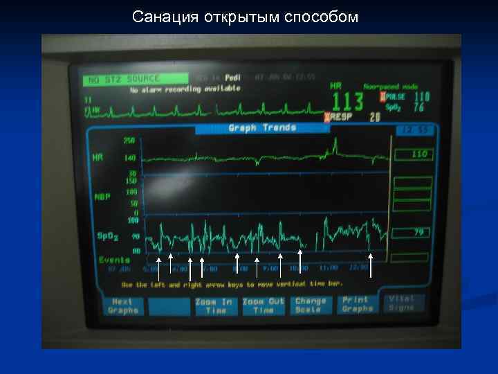Санация открытым способом 