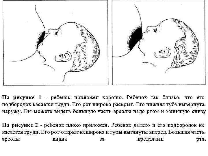 На рисунке 1 - ребенок приложен хорошо. Ребенок так близко, что его подбородок касается