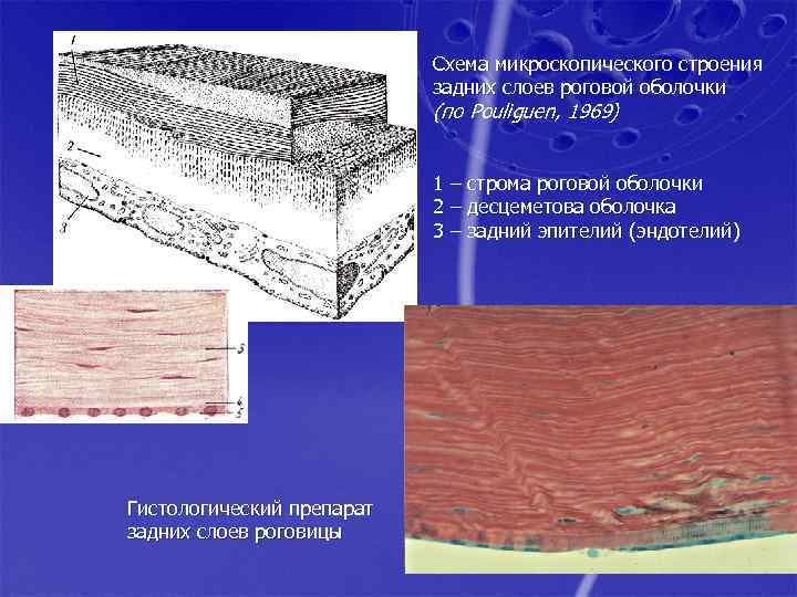 Схема микроскопического строения задних слоев роговой оболочки (по Pouliguen, 1969) 1 – строма роговой