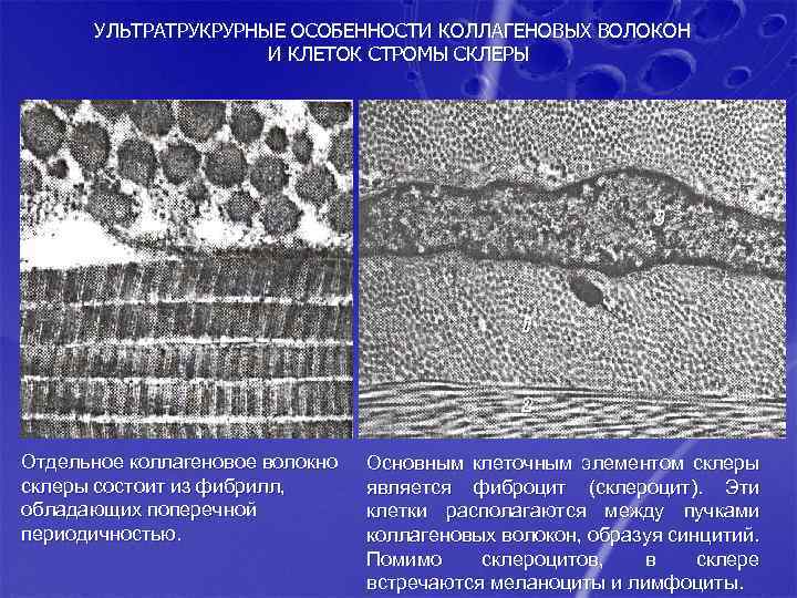 УЛЬТРАТРУКРУРНЫЕ ОСОБЕННОСТИ КОЛЛАГЕНОВЫХ ВОЛОКОН И КЛЕТОК СТРОМЫ СКЛЕРЫ Отдельное коллагеновое волокно склеры состоит из