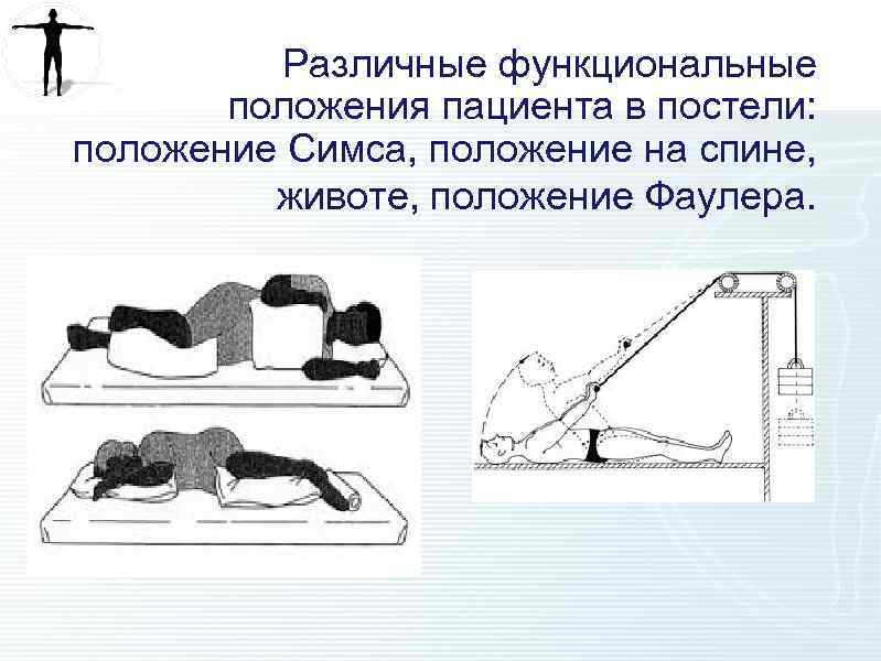 Различные функциональные положения пациента в постели: положение Симса, положение на спине, животе, положение Фаулера.