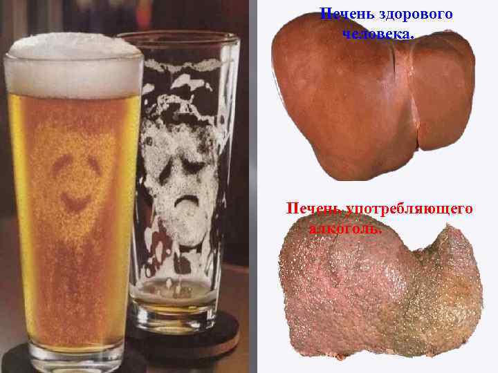 Печень здорового человека. Печень употребляющего алкоголь. 