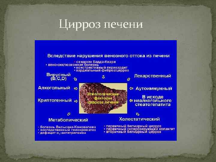 Цирроз печени 