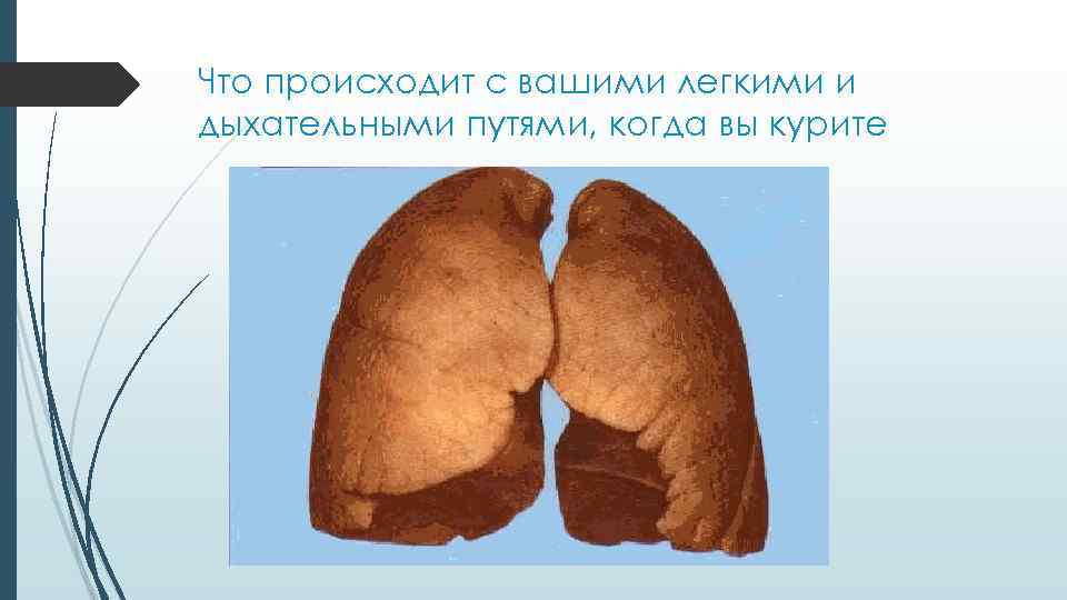 Что происходит с вашими легкими и дыхательными путями, когда вы курите 