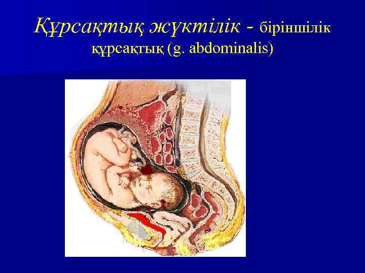 Құрсақтық жүктілік - біріншілік құрсақтық (g. abdominalis) 