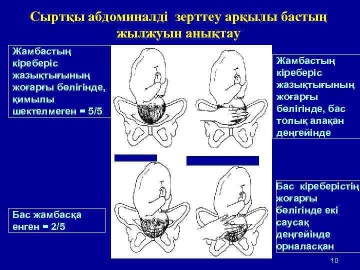 Сыртқы абдоминалді зерттеу арқылы бастың жылжуын анықтау Жамбастың кіреберіс жазықтығының жоғарғы бөлігінде, қимылы шектелмеген