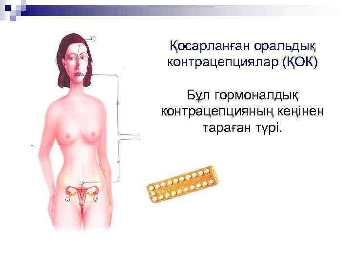 Қосарланған оральдық контрацепциялар (ҚОК) Бұл гормоналдық контрацепцияның кеңінен тараған түрі. 