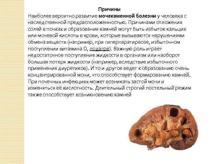Причины Наиболее вероятно развитие мочекаменной болезни у человека с наследственной предрасположенностью. Причинами отложения солей