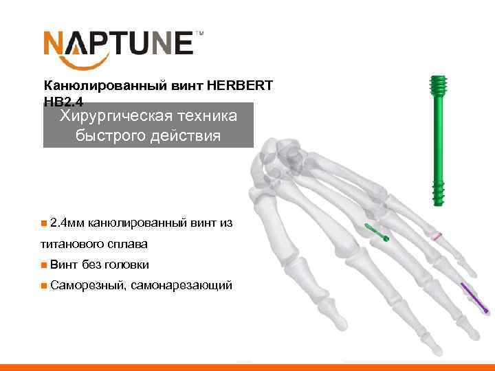 Канюлированный винт HERBERT HB 2. 4 Хирургическая техника быстрого действия n 2. 4 мм