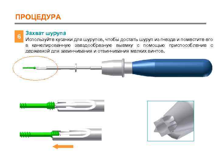 ПРОЦЕДУРА 6 Захват шурупа Используйте кусачки для шурупов, чтобы достать шуруп из гнезда и