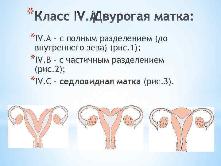 * *IV. А - с полным разделением (до внутреннего зева) (рис. 1); *IV. В