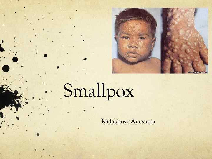Smallpox Malakhova Anastasia 