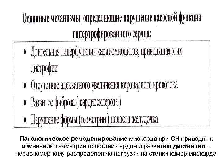 Патологическое ремоделирование миокарда при СН приводит к изменению геометрии полостей сердца и развитию дистензии