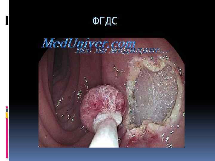 ФГДС 