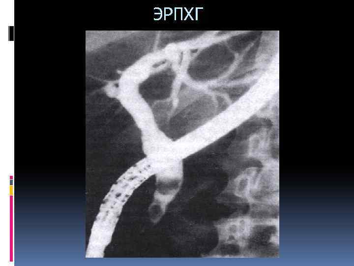 ЭРПХГ 