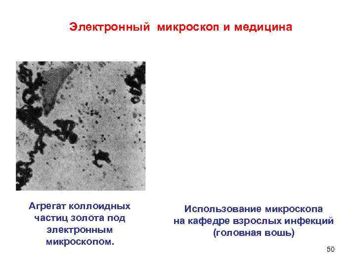 Электронный микроскоп и медицина Агрегат коллоидных частиц золота под электронным микроскопом. Использование микроскопа на