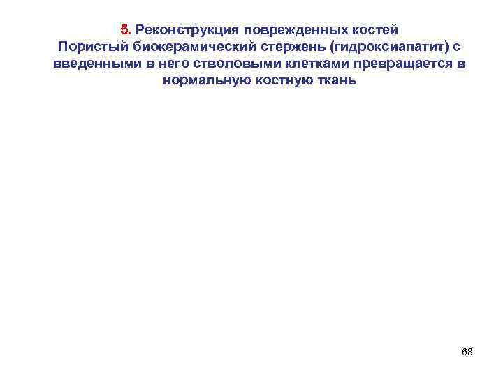 5. Реконструкция поврежденных костей Пористый биокерамический стержень (гидроксиапатит) с введенными в него стволовыми клетками