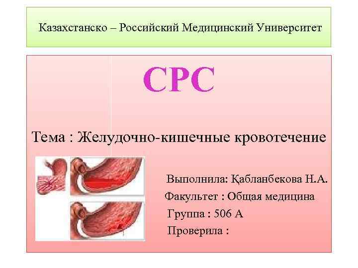 Казахстанско – Российский Медицинский Университет СРС Тема : Желудочно-кишечные кровотечение Выполнила: Қабланбекова Н. А.