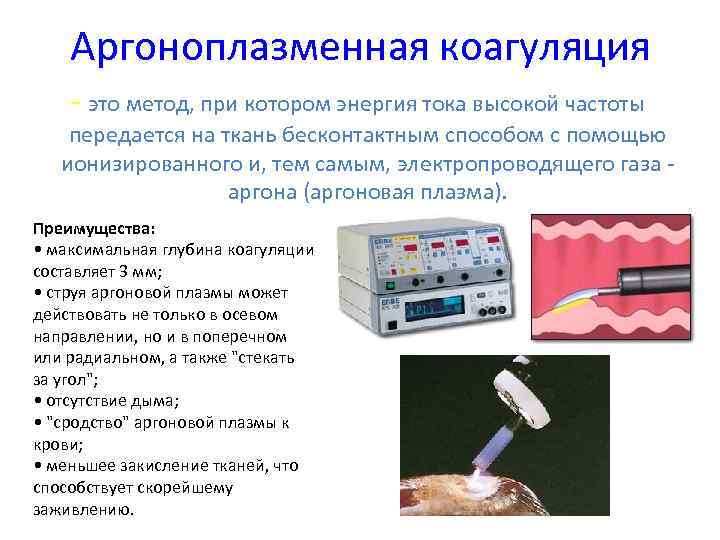 Аргоноплазменная коагуляция - это метод, при котором энергия тока высокой частоты передается на ткань