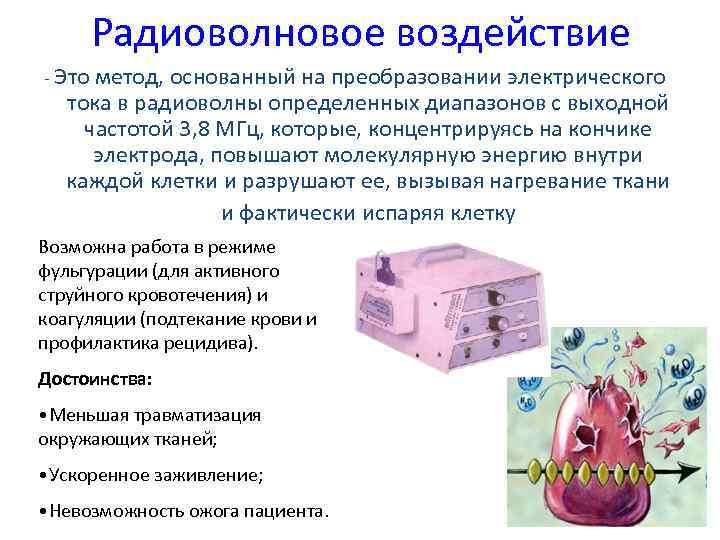 Радиоволновое воздействие - Это метод, основанный на преобразовании электрического тока в радиоволны определенных диапазонов