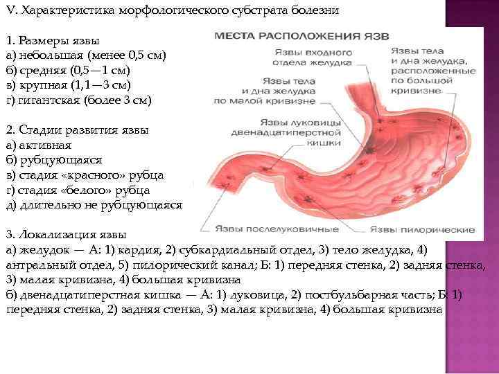 V. Характеристика морфологического субстрата болезни 1. Размеры язвы а) небольшая (менее 0, 5 см)