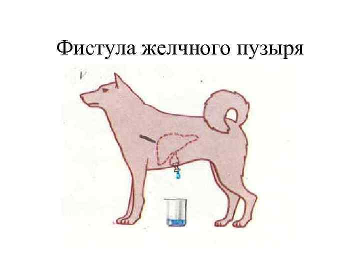 Фистула желчного пузыря 